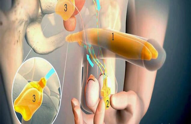 Operazione di lipofilling